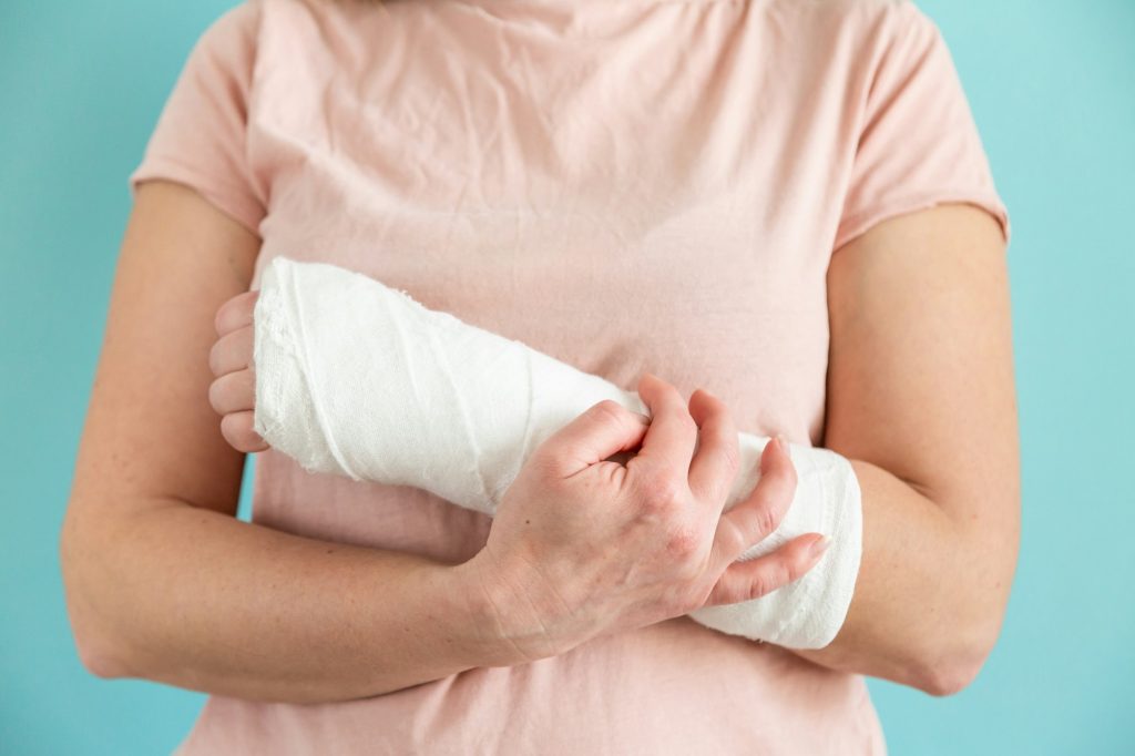Woman with broken arm. Hand in a plaster bandage. Gypsum medical